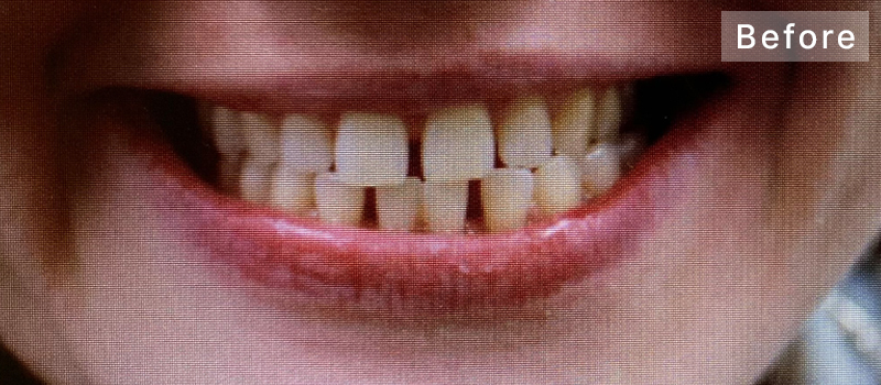 Before