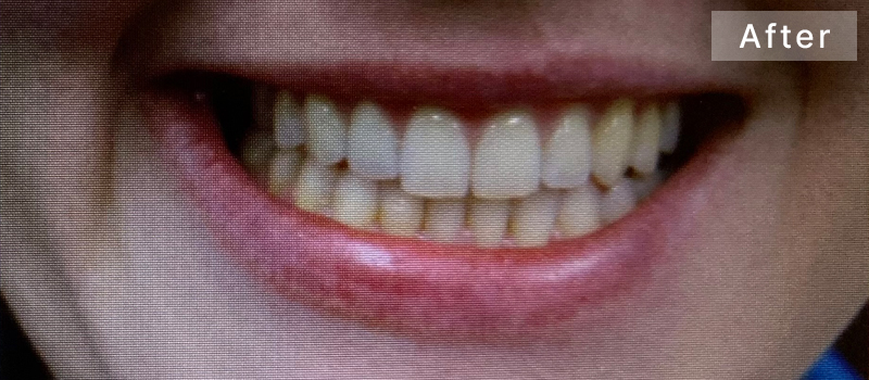 After