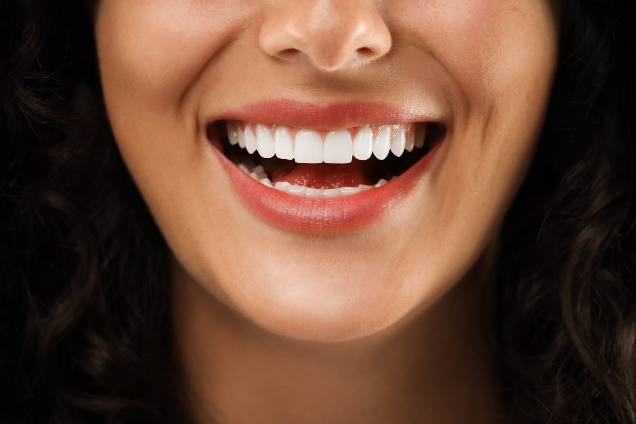 Close up of a woman's white and straight smile
