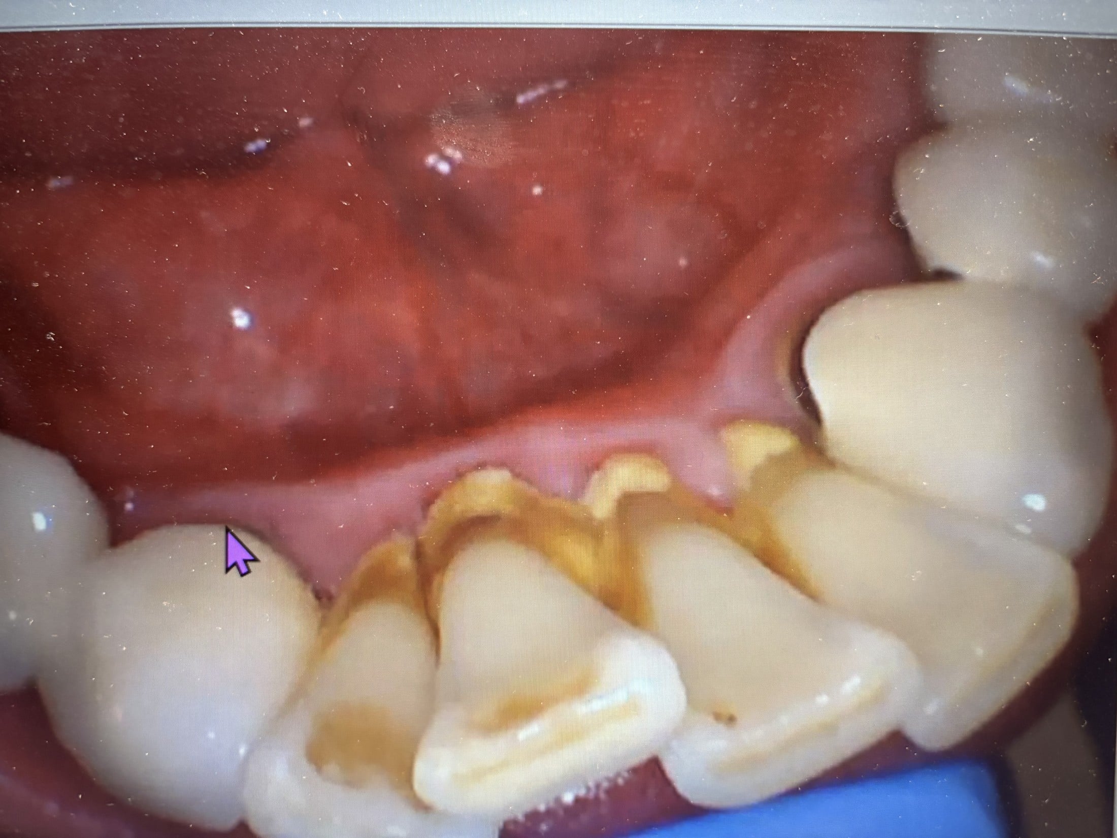 Patient's smile before dental treatment at Heavenly Smiles Dentist