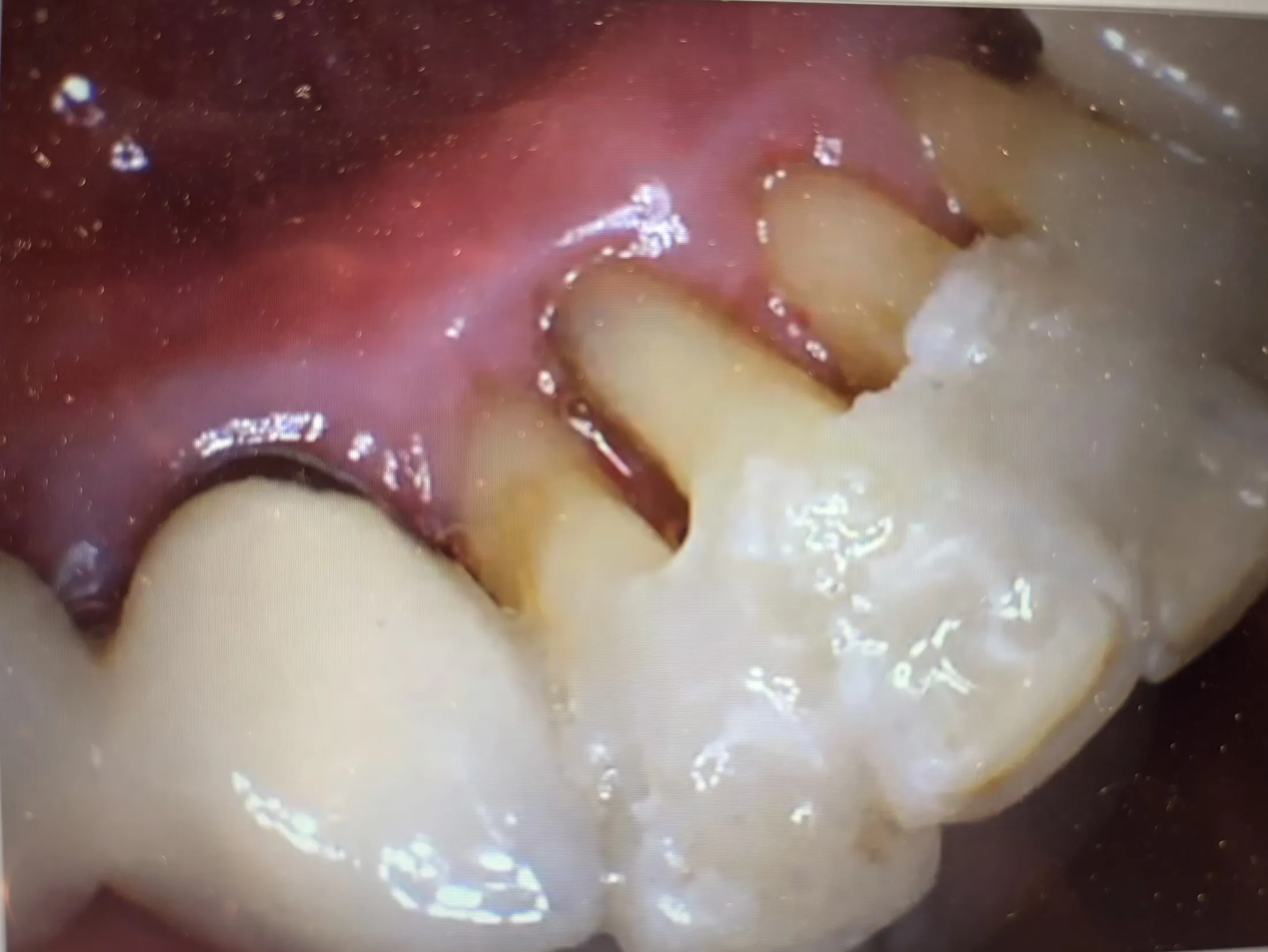 Patient's smile after dental treatment at Heavenly Smiles Dentist